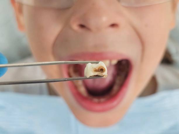 Best Emergency Broken Tooth Repair in Blennerhassett, WV
