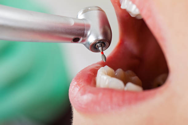 Best Emergency Treatment for Toothache in Blennerhassett, WV